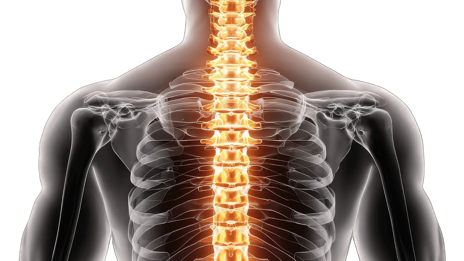 spinal cord stimulation