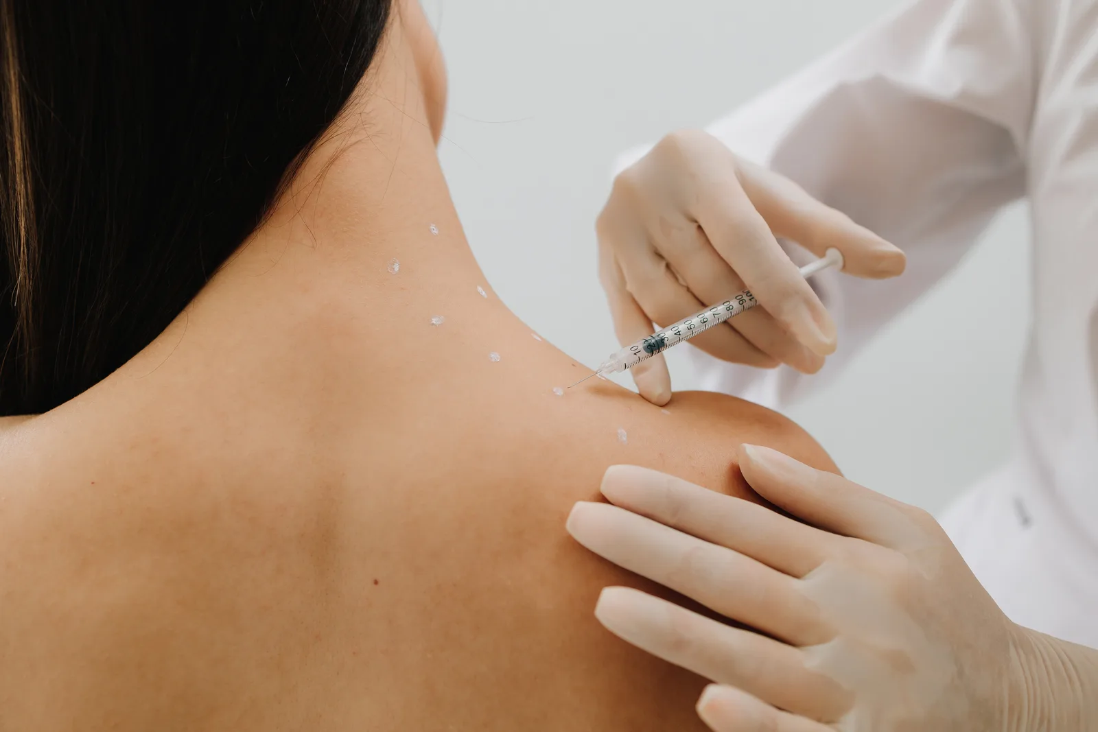 Trigger Point Injections at APICO Pain Management