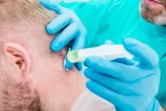 Occipital Nerve Block at APICO Pain Management