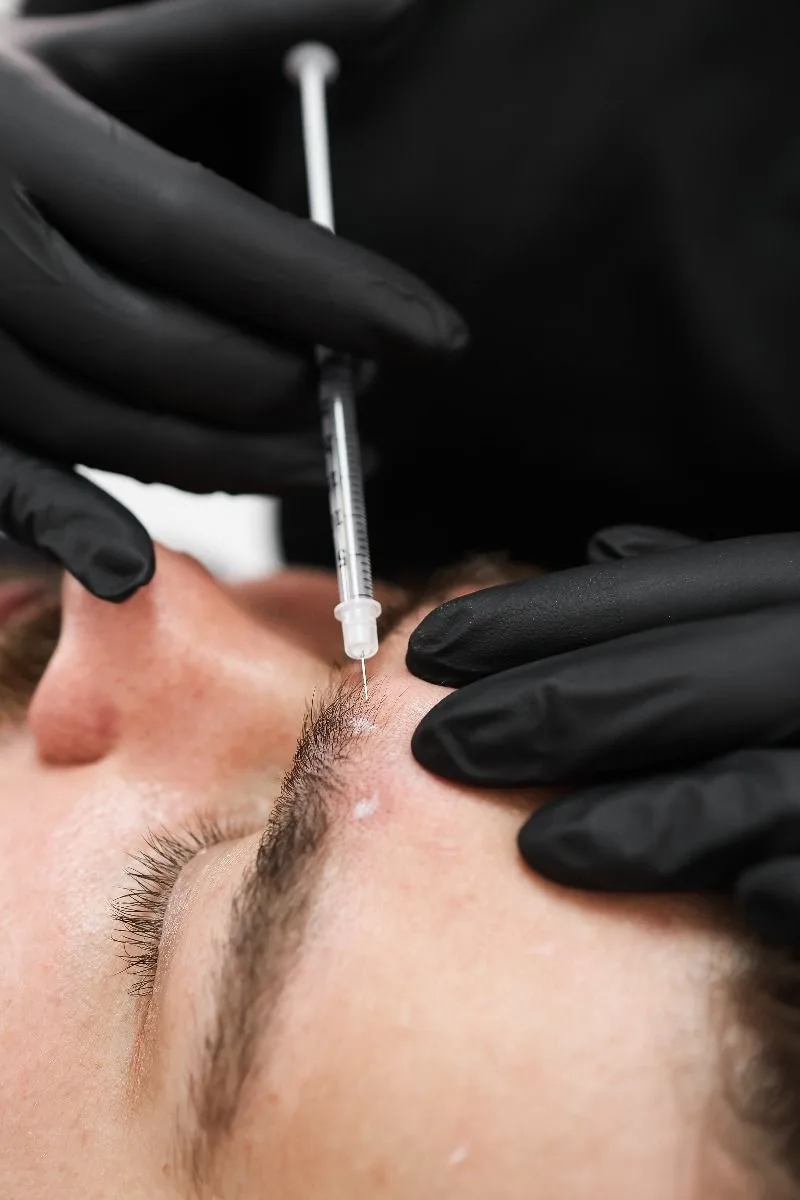 Botox Injections at APICO Pain Management