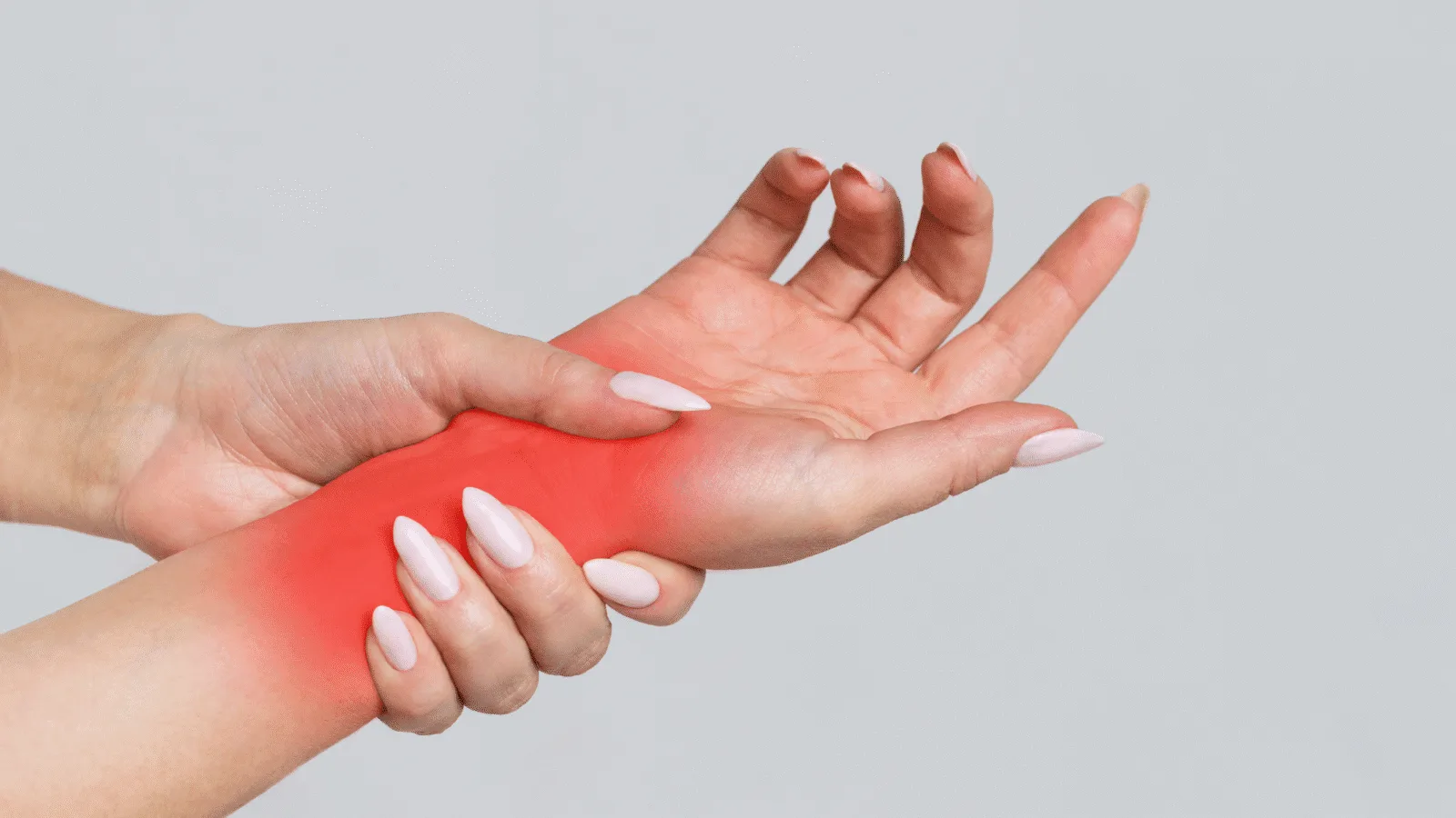 Complex Regional Pain Syndrome