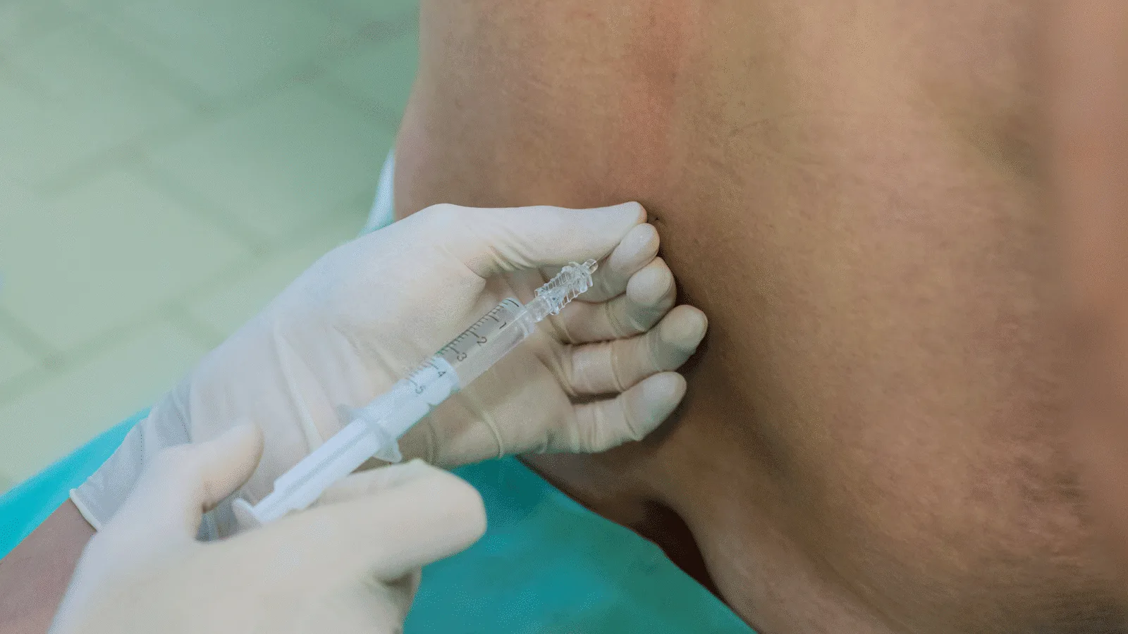 epidural steroid injections