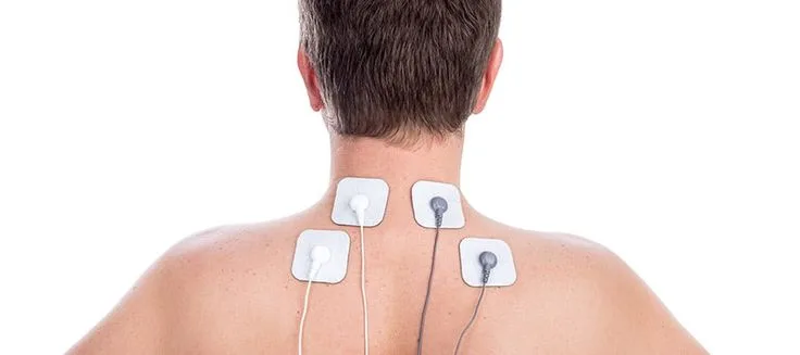 Dorsal Root Ganglion Stimulator at APICO Pain Management