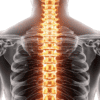 Spinal Cord Stimulation: A Treatment Option for Long-Term Pain Relief